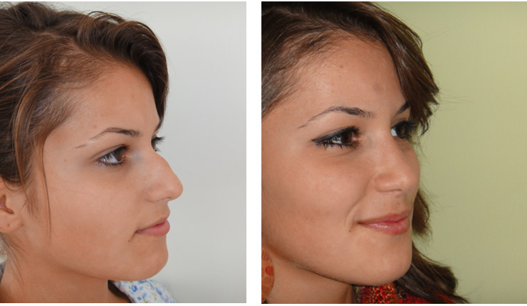 modelare nas